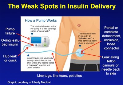 Infusion Set Failure - Diabetesnet.com