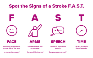 Infographic explaining FAST method of recognizing a stroke.